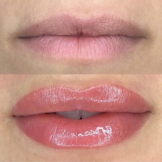 Lip Blushing